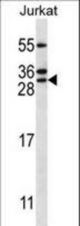 RAB5C Antibody western blot of Jurkat cell line lysates (35 ug/lane). The RAB5C antibody detected the RAB5C protein (arrow).