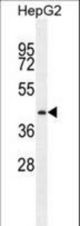 PRRT1 Antibody western blot of HepG2 cell line lysates (35 ug/lane). The PRRT1 antibody detected the PRRT1 protein (arrow).