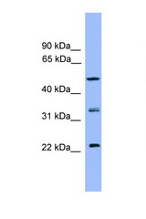 RAB8B antibody LS-C135581 Western blot of HepG2 Cell lysate. Antibody concentration 1 ug/ml.