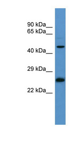 RAB8B antibody LS-C135580 Western blot of COLO205 cell lysate.