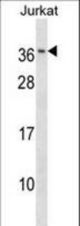 RAB8B Antibody western blot of Jurkat cell line lysates (35 ug/lane). The RAB8B antibody detected the RAB8B protein (arrow).