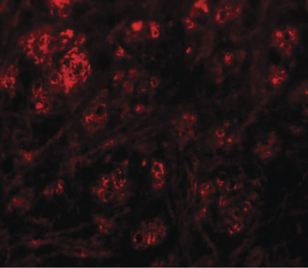 Immunofluorescence of RABEX5 in mouse brain tissue with RABEX5 antibody at 20 ug/ml.