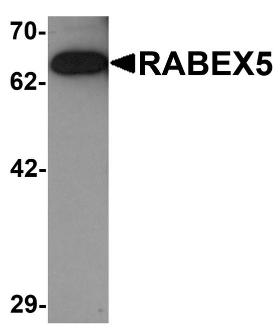 Western blot analysis of RABEX5 in rat brain tissue lysate with RABEX5 antibody at 1 ug/ml.