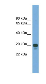 PRRX2 antibody LS-C117207 Western blot of Fetal Heart lysate.