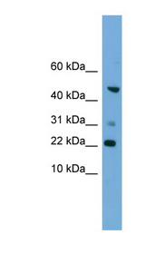 RAC1 antibody western blot of HepG2 cell lysate.