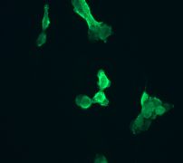 IHC of A431-2 using anti-Phospho-Rac1/Cdc42 (pS71) antibody (LS-C105427).