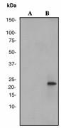 Western blot analysis on A431 cell lysates using anti-Phospho-Rac1/Cdc42 (pS71) antibody (LS-C105427), 1:1000 dilution. Cells were either (A) untreated (B) treated with Lambda Phosphatase