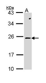 Sample (30 ug of whole cell lysate). A: Molt-4. 12% SDS PAGE. RAC2 antibody diluted at 1:1000.