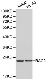 Western blot of RAC2 pAb in extracts from Jurkat and HL-60 cells.