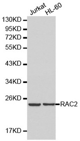 Western blot analysis of Jurkat cell and HL-60 cell lysate using RAC2 antibody.