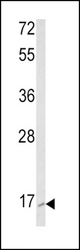 Western blot of RAC2 Antibody in K562 cell line lysates (35 ug/lane). RAC2 (arrow) was detected using the purified antibody.