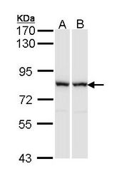 Sample (30 ug of whole cell lysate). A: A431 , B: Raji. 7.5% SDS PAGE. RACGAP1 / MGCRACGAP antibody diluted at 1:1000.