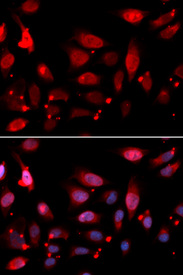 Immunofluorescence analysis of U20S cell using RACGAP1 antibody. Blue: DAPI for nuclear staining.