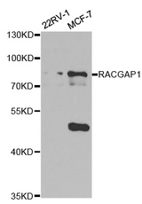 Western blot analysis of extracts of various cell lines, using RACGAP1 antibody.