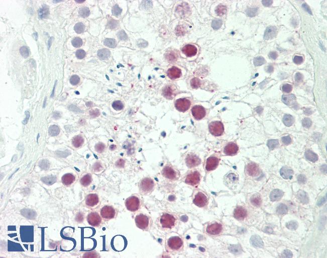Human Testis: Formalin-Fixed, Paraffin-Embedded (FFPE)