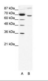 A: Marker, B: HepG2 Cell Lysate