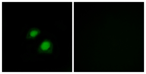 Immunofluorescence of COS7 cells, using RGAP1 Antibody. The picture on the right is treated with the synthesized peptide.