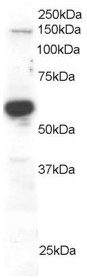 Antibody staining (0.2 ug/ml) of Human Testis lysate (RIPA buffer, 30 ug total protein per lane). Primary incubated for 1 hour. Detected by Western blot of chemiluminescence.