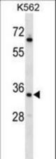RAD1 Antibody western blot of K562 cell line lysates (35 ug/lane). The RAD1 antibody detected the RAD1 protein (arrow).