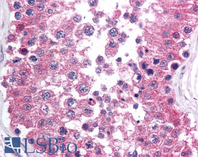 Anti-RAD1 antibody IHC of human testis. Immunohistochemistry of formalin-fixed, paraffin-embedded tissue after heat-induced antigen retrieval. Antibody LS-B1706 concentration 10 ug/ml.