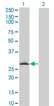 Western blot of RAD1 expression in transfected 293T cell line by RAD1 monoclonal antibody (M01), clone 1G2.
