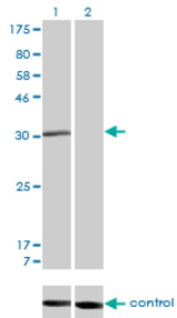 Western blot of RAD1 over-expressed 293 cell line, cotransfected with RAD1 Validated Chimera RNAi (Lane 2) or non-transfected control (Lane 1). Blot probed with RAD1 monoclonal antibody, clone 1G2. GAPDH ( 36.1 kD ) used as specificity an.