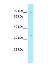 RAD17 antibody LS-C109569 Western blot of Fetal Liver lysate. Antibody concentration 1 ug/ml.