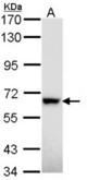 Sample (30 ug of whole cell lysate). A: Hep G2 . 7.5% SDS PAGE. RAD18 antibody diluted at 1:1000.