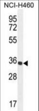 PRSS1 Antibody western blot of NCI-H460 cell line lysates (35 ug/lane). The PRSS1 antibody detected the PRSS1 protein (arrow).