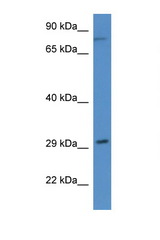 RAD21 antibody LS-C135398 Western blot of Rat Heart lysate. Antibody concentration 1 ug/ml.