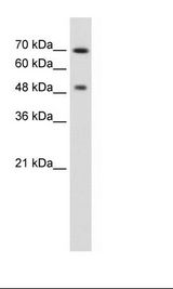 Jurkat Cell Lysate