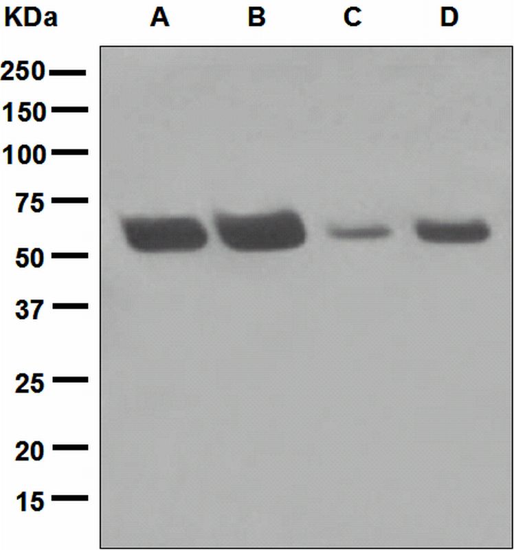 Western blot analysis on (A) MCF-7, (B) Jurkat, (C) Raji, and (D) HeLa cell lysates using anti-RAD23A antibody.
