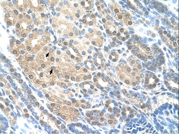 RAD23A / HHR23A antibody LS-C31975 was used in IHC to stain formalin-fixed, paraffin-embedded human kidney.