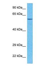 Western blot of TSSP Antibody with human Ovary Tumor lysate.