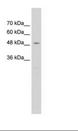 Jurkat Cell Lysate