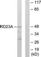 Western blot of extracts from LOVO cells, using RAD23A Antibody. The lane on the right is treated with the synthesized peptide.