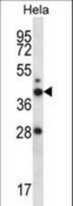 RAD23A Antibody western blot of HeLa cell line lysates (35 ug/lane). The RAD23A antibody detected the RAD23A protein (arrow).