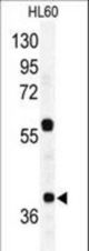Western blot of RAD23A Antibody in HL60 cell line lysates (35 ug/lane). RAD23A (arrow) was detected using the purified antibody.