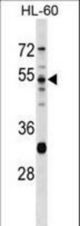 PRSS16 Antibody western blot of HL-60 cell line lysates (35 ug/lane). The PRSS16 antibody detected the PRSS16 protein (arrow).