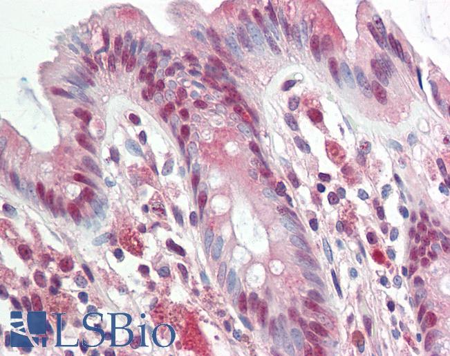 Human Colon: Formalin-Fixed, Paraffin-Embedded (FFPE)
