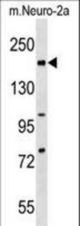Mouse Rad50 Antibody western blot of mouse Neuro-2a cell line lysates (35 ug/lane). The Rad50 antibody detected the Rad50 protein (arrow).