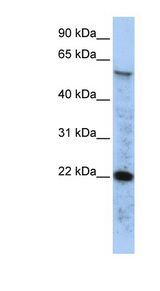 RAD51 antibody LS-B4573 Western blot of HepG2 cell lysate.
