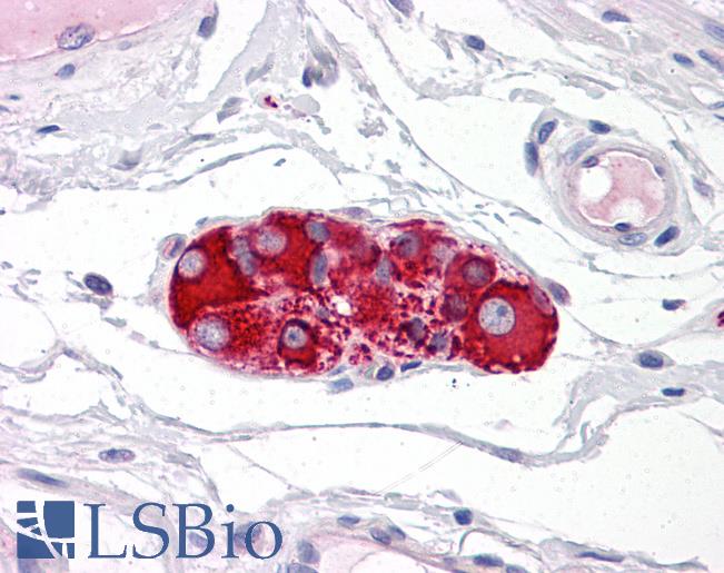 Anti-RAD51AP1 antibody IHC of human small intestine, submucosal plexus. Immunohistochemistry of formalin-fixed, paraffin-embedded tissue after heat-induced antigen retrieval. Antibody LS-B4839 concentration 10 ug/ml.
