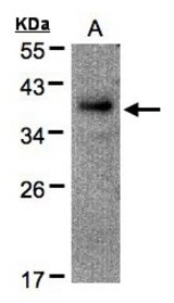 Sample(30 g of whole cell lysate). A: Raji. 12% SDS PAGE. RAD51AP1 antibody diluted at 1:500.