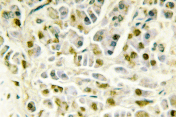 IHC of Rad51B (G226) pAb in paraffin-embedded human pancreas tissue.