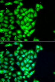 Immunofluorescence blot of U20S cell using RAD51L1 antibody. Blue: DAPI for nuclear staining.