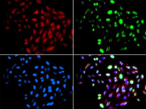 Immunofluorescence blot of GFP-RNF168 transgenic U2OS cell using RAD51L1 antibody. Green: GFP-RNF168 fusion protein expression for DNA damage marker. Blue: DAPI for nuclear staining. RNF168(GFP) can be used to mark cells damaged by UV-A laser as they always gather around DNA damage region.