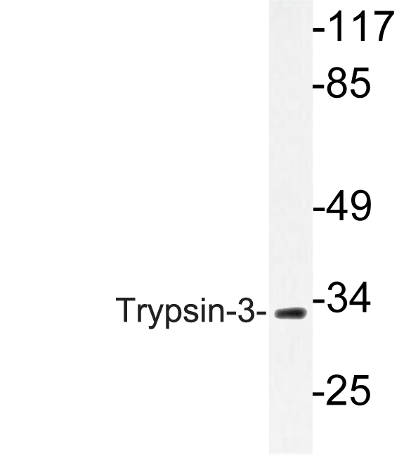Western blot of Trypsin-3 (M166) pAb in extracts from A549 cells.