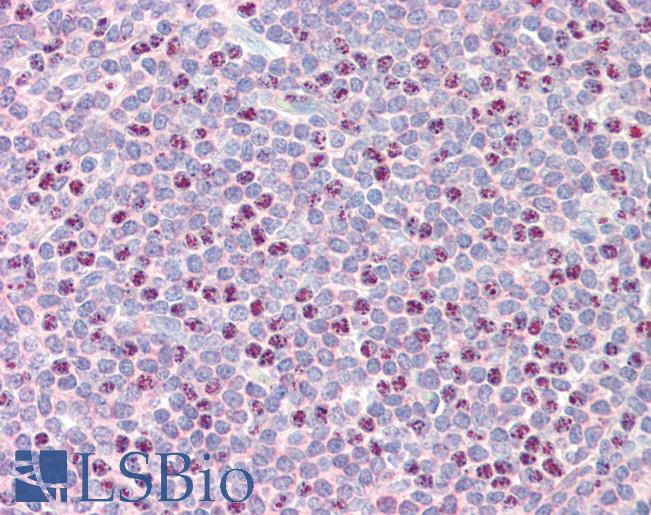 Anti-RAD51B antibody IHC staining of human tonsil. Immunohistochemistry of formalin-fixed, paraffin-embedded tissue after heat-induced antigen retrieval. Antibody LS-B9754 concentration 10 ug/ml.