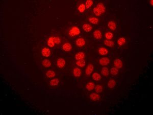 Immunofluorescent staining of MCF-7 cells using anti-Rad51B antibody.